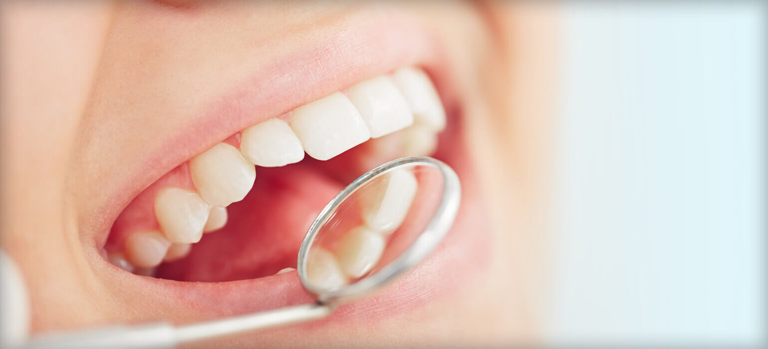 ourservices_preventativedentistry mirror showing inside of mouth