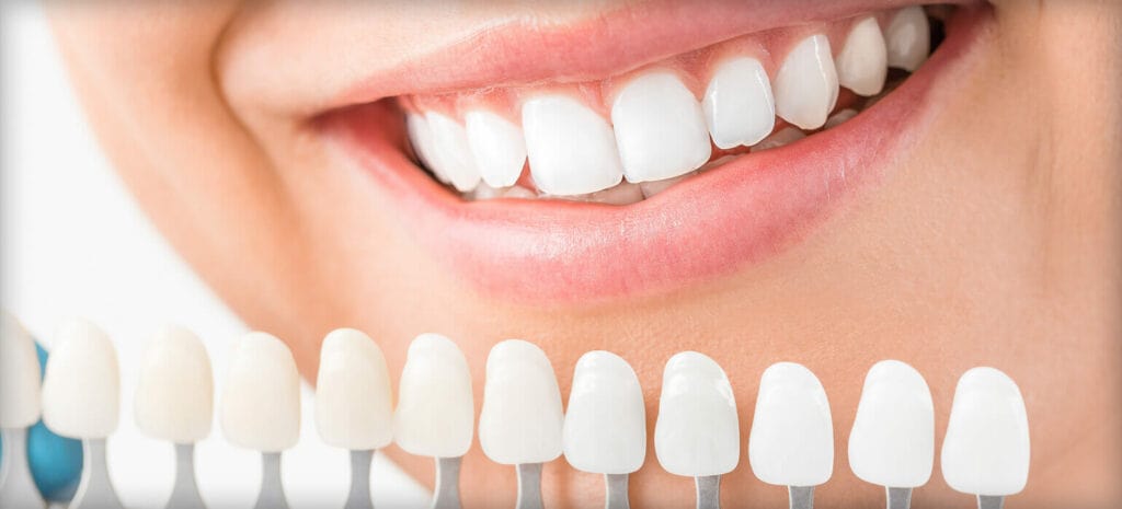 Ourservices Cosmeticdentistry smile